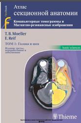 Атлас секционной анатомии, Голова и шея, Том 1, Moeller T.В., Reif E.