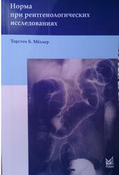 Норма при рентгенологических исследованиях, Мёллер Т.Б., 2014
